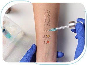 Allergy Patch Testing Near Me in McLean VA, Alexandria VA, Arlington VA, Bethesda MD, Gaithersburg MD, and Rockville MD
